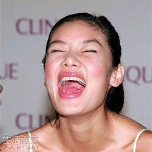 很多明星都有蛀牙,揭秘明星蛀牙背后的口腔健康问题